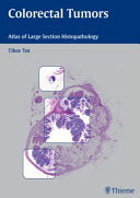 Colorectal Tumors: Atlas of Large Section Histopathology