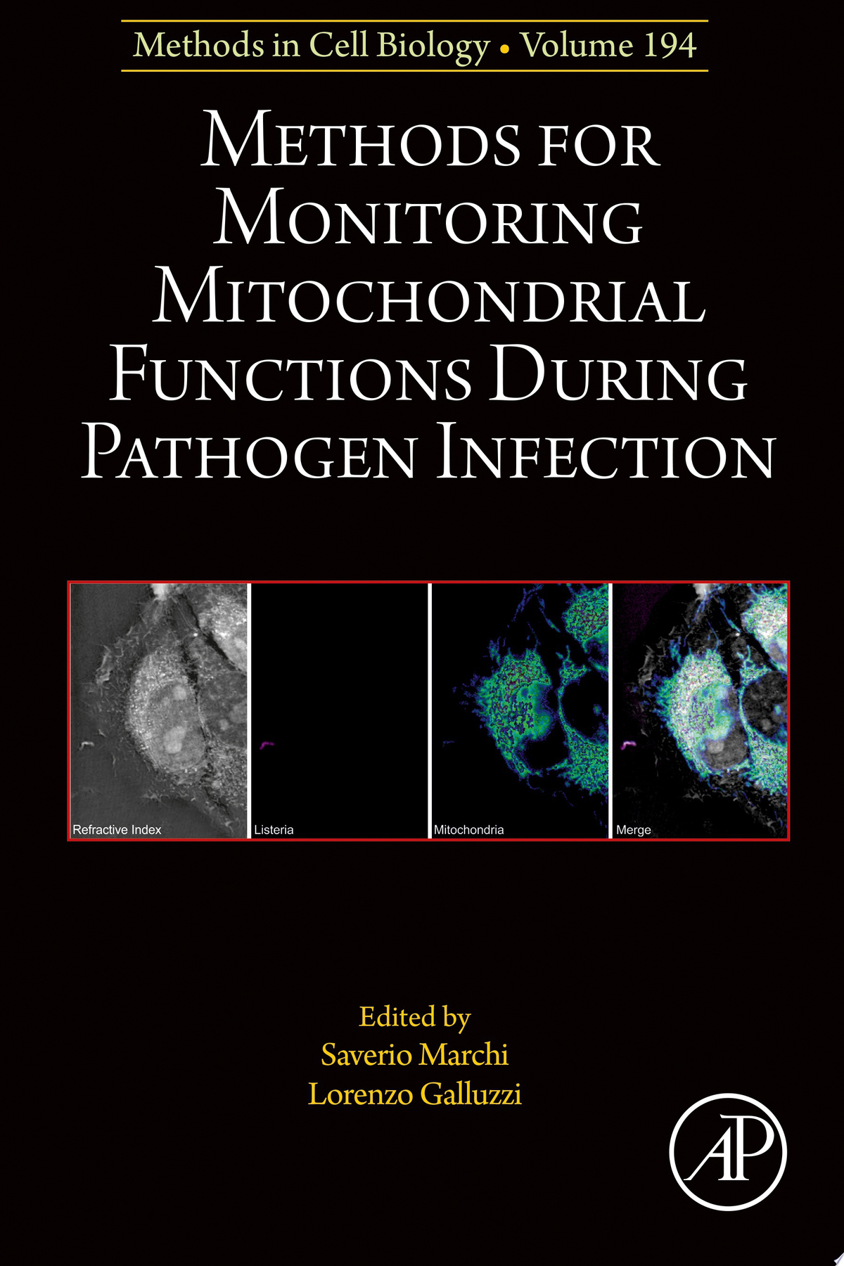 Methods for Monitoring Mitochondrial Functions During Pathogen Infection
