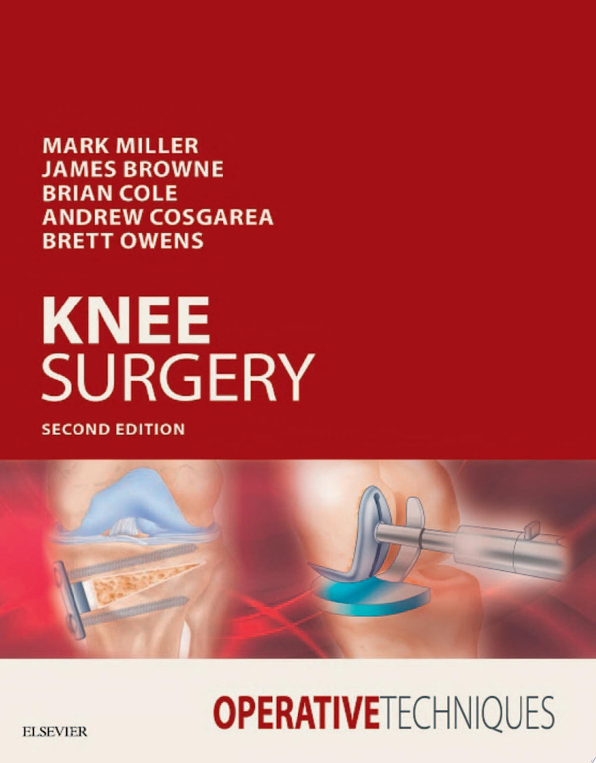 Operative Techniques: Knee Surgery, 2nd Edition