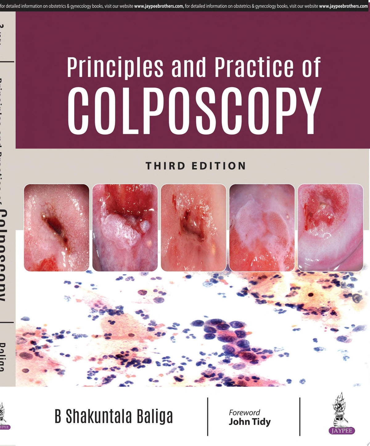 Colposcopy in Practical Gynecology, 3rd Edition