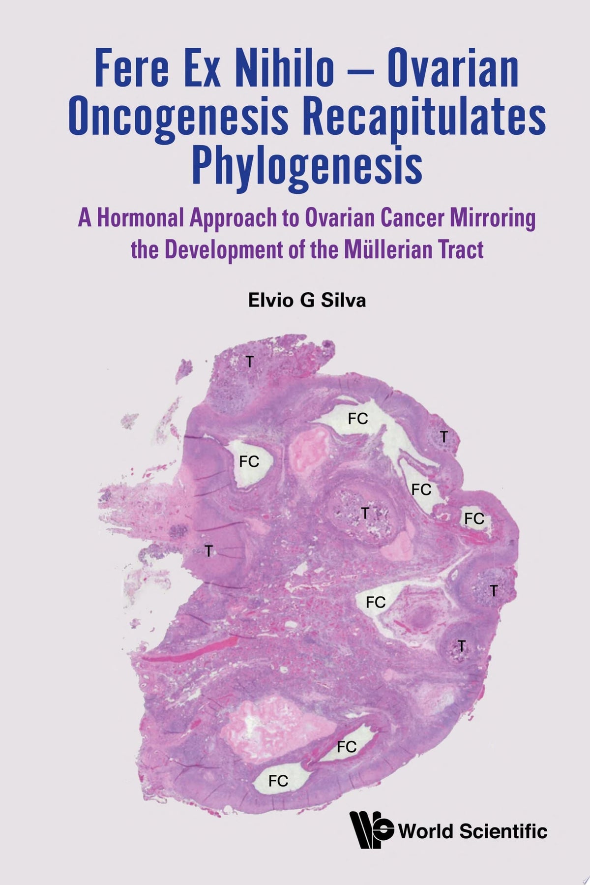 Fere Ex Nihilo — Ovarian Oncogenesis Recapitulates Phylogenesis: A Hormonal Approach to Ovarian Cancer Mirroring the Development of the Müllerian Tract