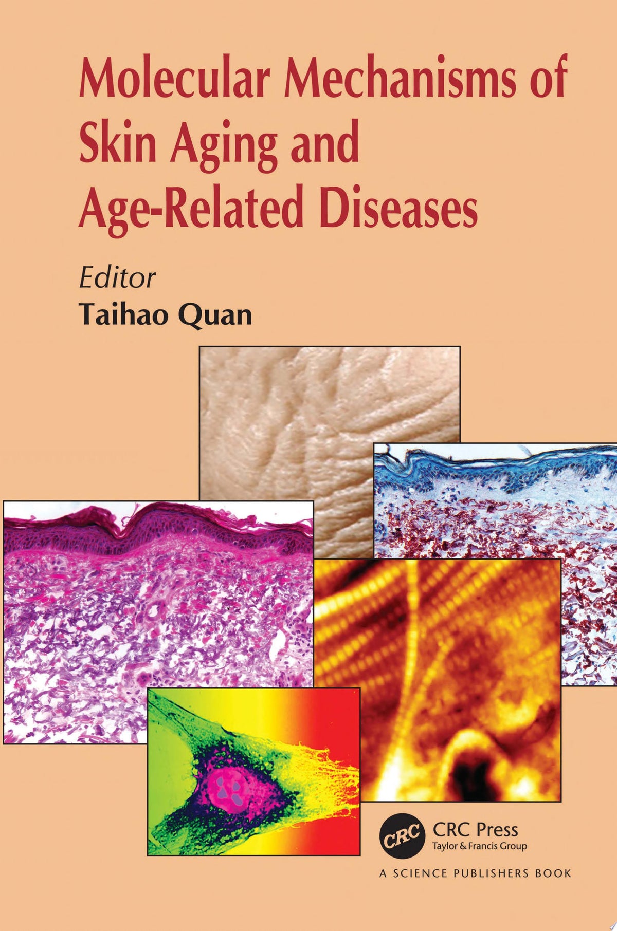Molecular Mechanisms of Skin Aging and Age-Related Diseases