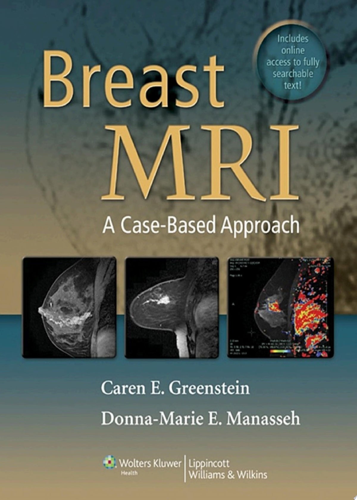 Breast MRI: A Case-Based Approach