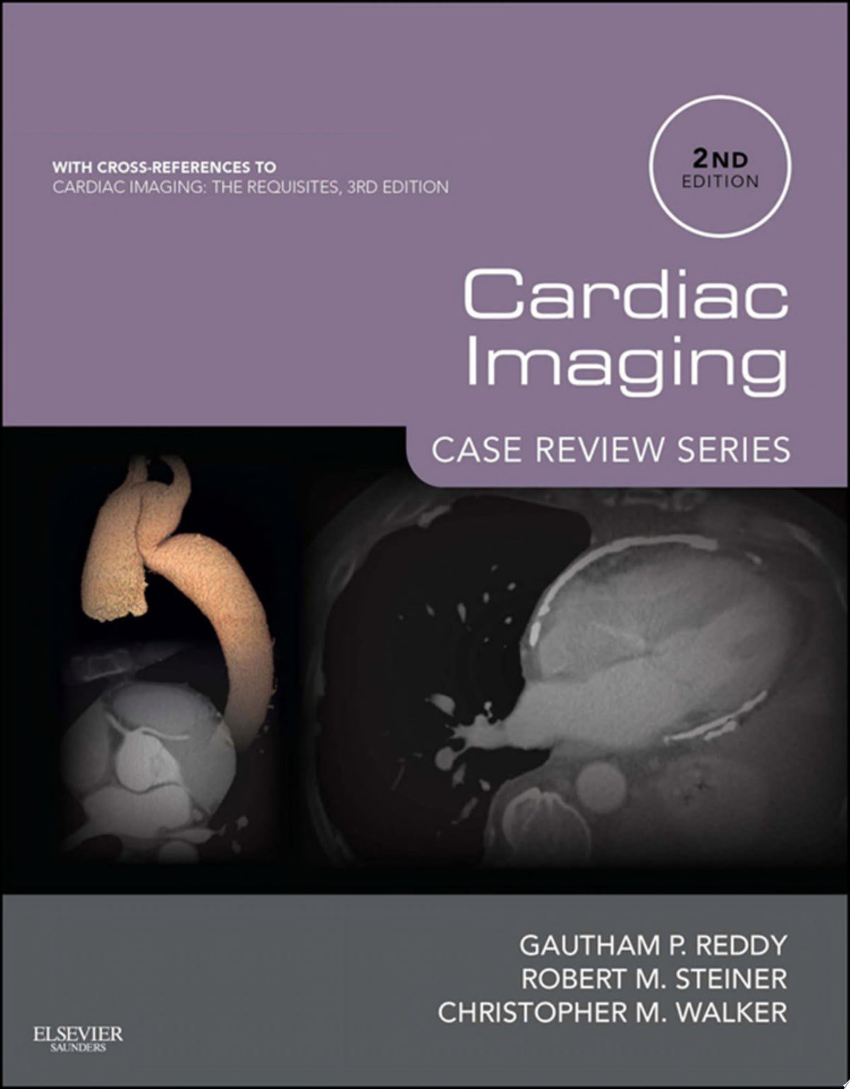 Cardiac Imaging: Case Review Series, 2nd Edition