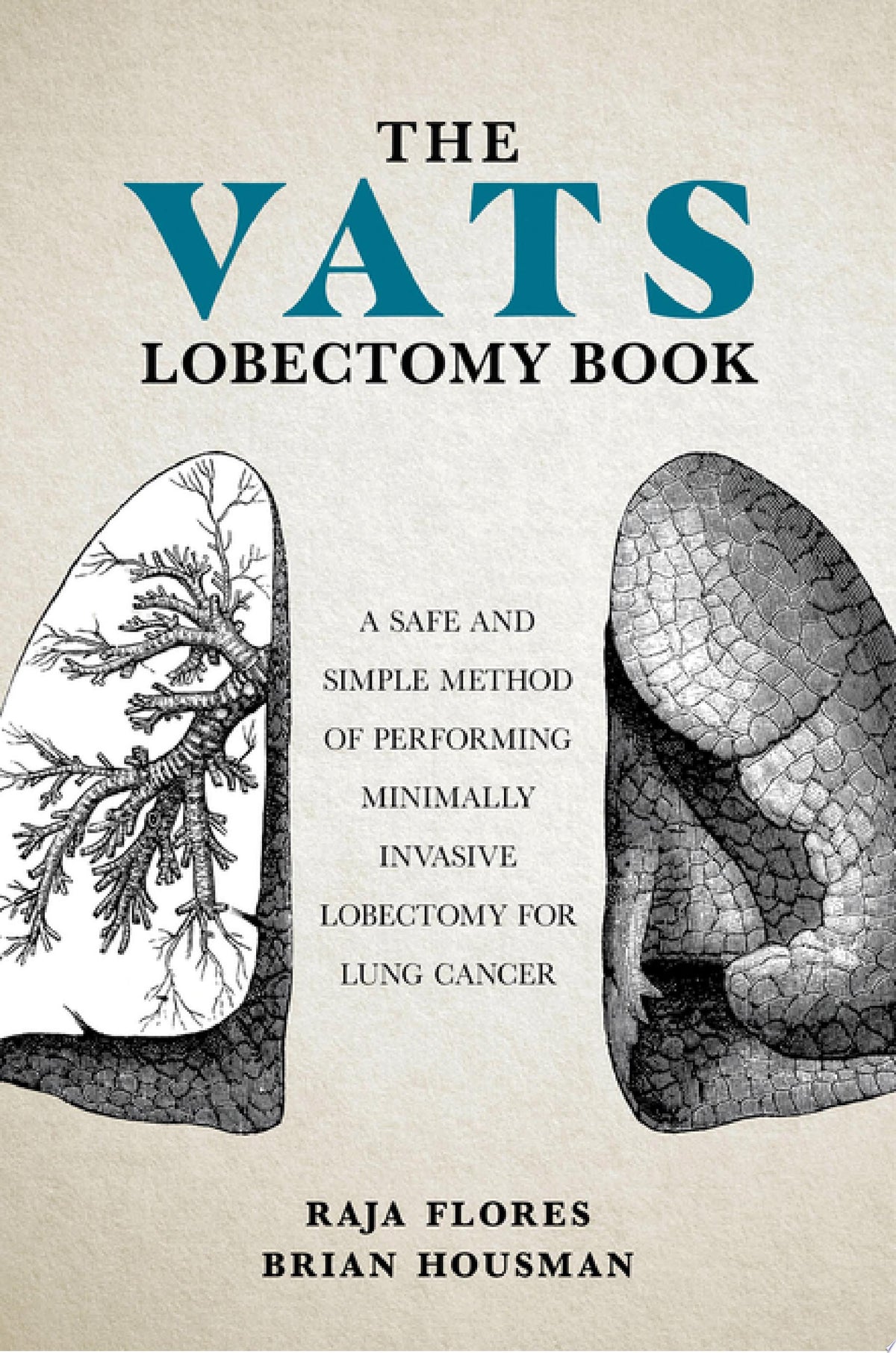 The VATS Lobectomy Book