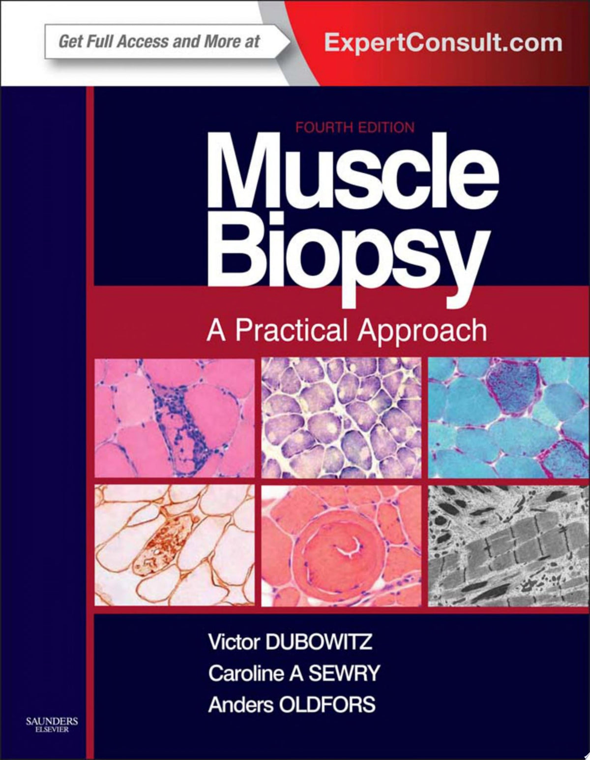 Muscle Biopsy: A Practical Approach, 5ed