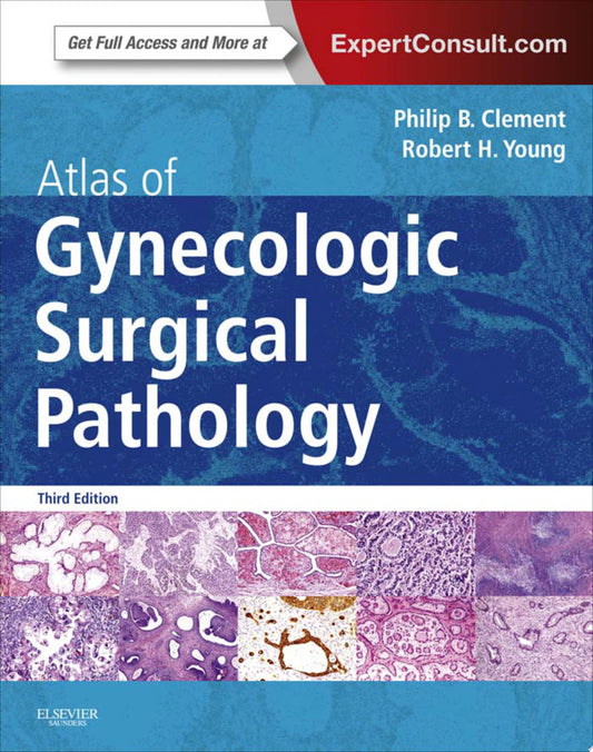 Atlas of Gynecologic Surgical Pathology: Expert Consult: Online and Print, 3e