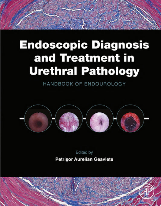 Endoscopic Diagnosis and Treatment in Urethral Pathology: Handbook of Endourology