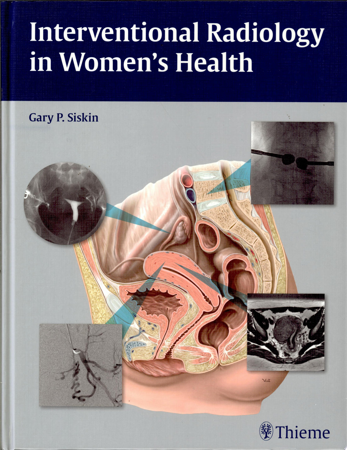 Interventional Radiology in Women’s Health