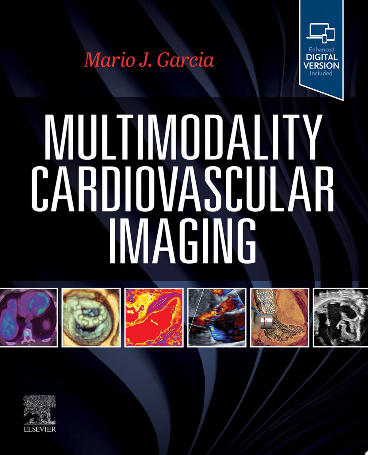 Multimodal Cardiac Imaging