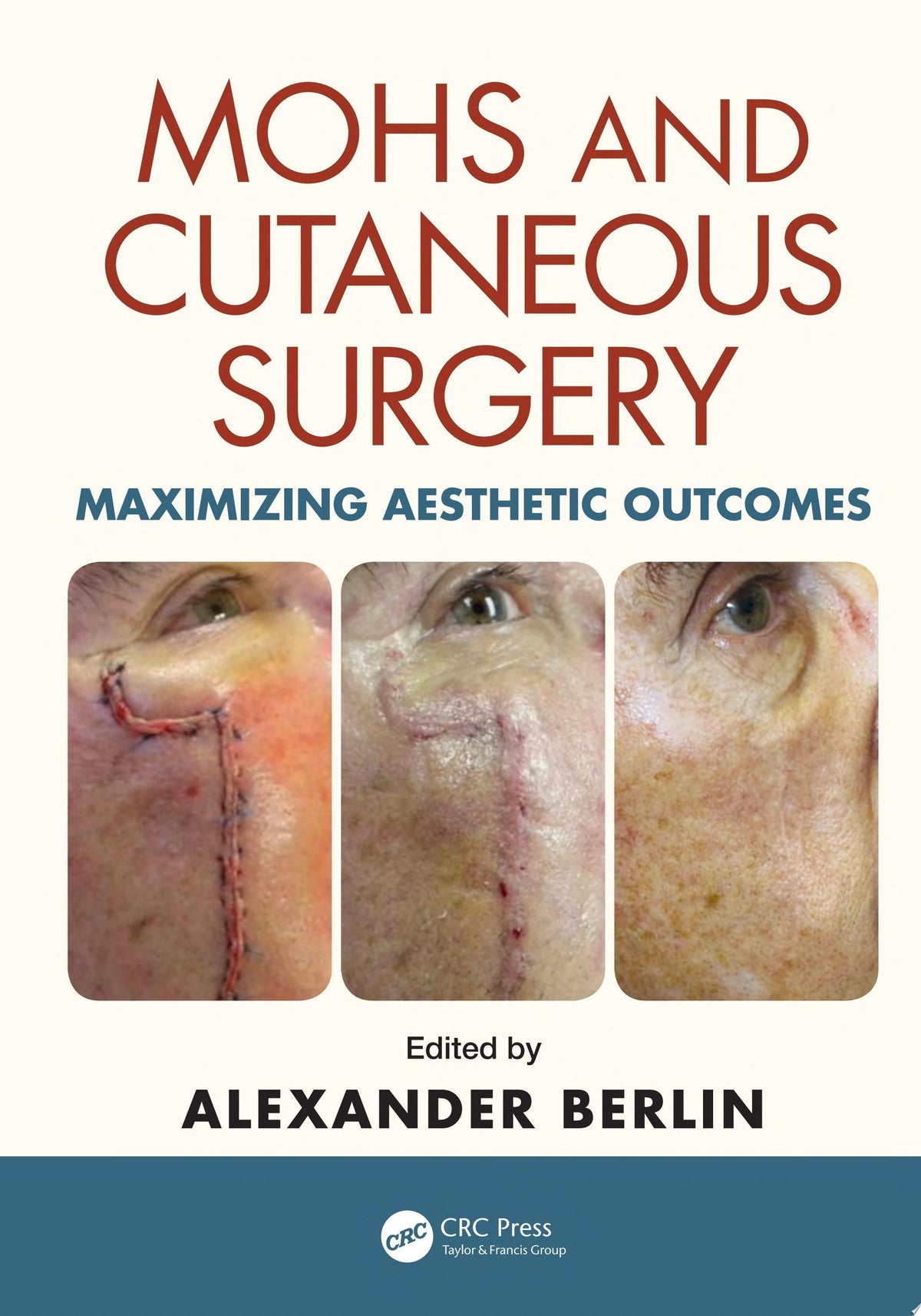 Mohs and Cutaneous Surgery: Maximizing Aesthetic Outcomes